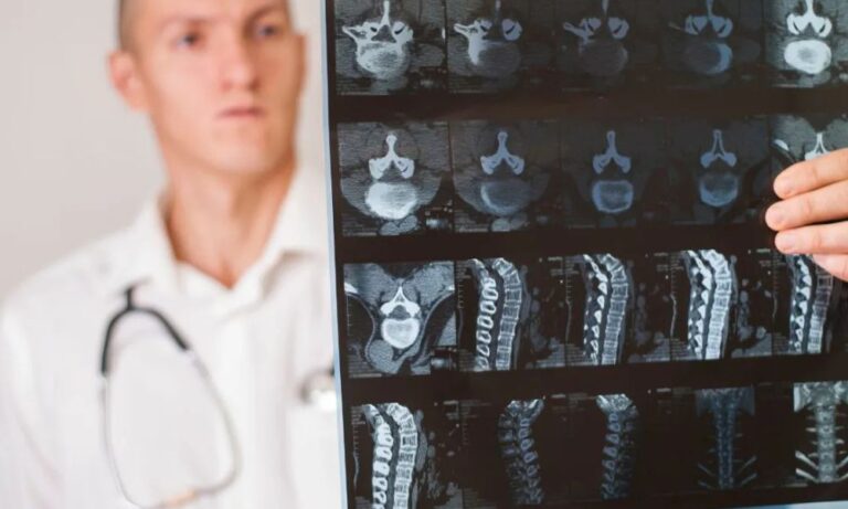 A fogászat új dimenziója: Amikor a CBCT röntgen 3D-ben látja a problémát